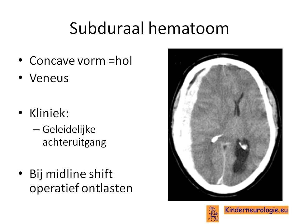 Diagnostiek Kinderneurologie